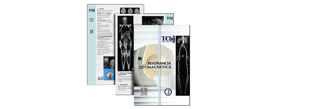 TCba Salguero Resonancia Magnética
